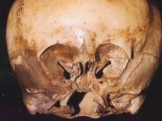 「スターチャイルド頭蓋骨」の謎とは？ DNA鑑定で“非人間”、宇宙人とのハイブリッドか？