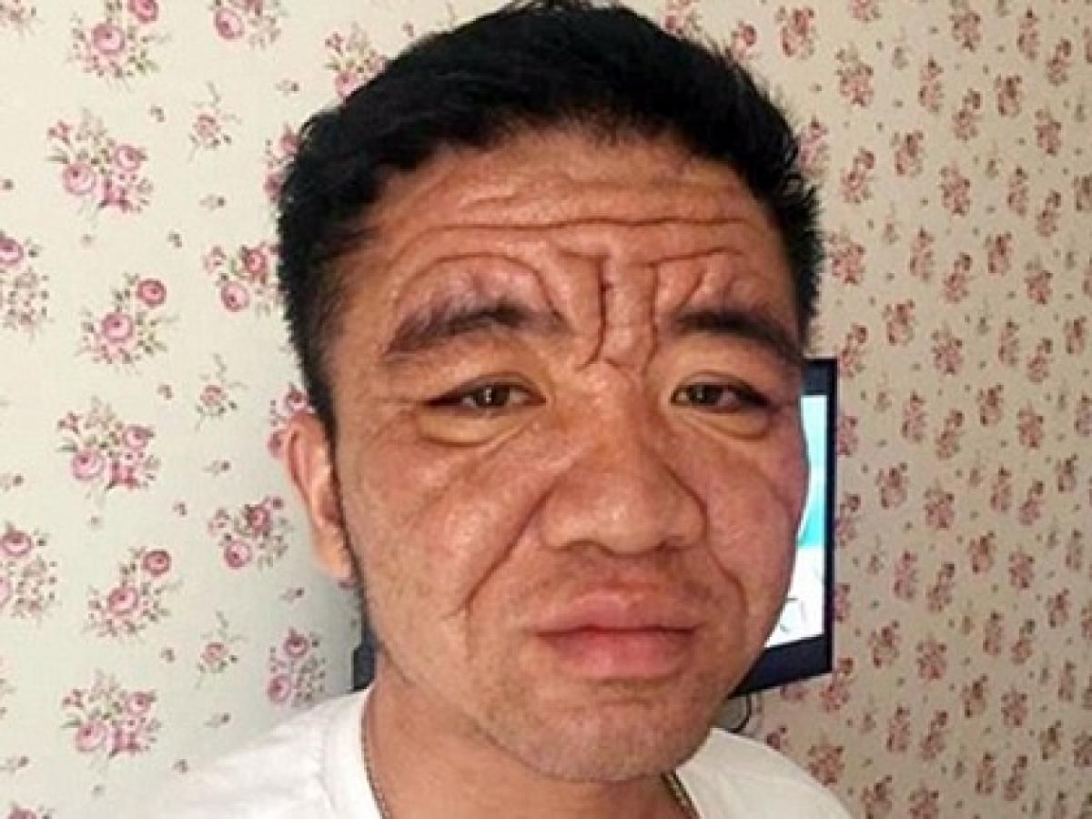 30歳なのに80歳の容姿 男が突然 超老け顔 になった謎の症状が怖すぎる 中国