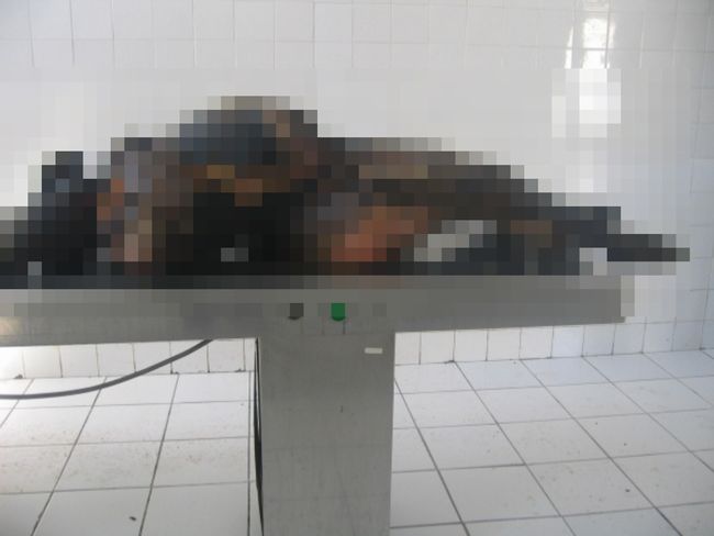 【超・閲覧注意】妊婦の焼死体から取り出された胎児が不憫すぎる! その姿は意外にも… 母体と運命を共にした小さな命の画像2