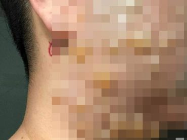 整形手術の検索結果 Tocana