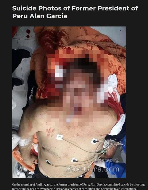 【閲覧注意】ペルー元大統領が拳銃自殺、ヤバすぎる遺体画像が流出! 頭蓋骨が完全に割れ、口の中にチューブ、死体を捧げる遺書も…!の画像1