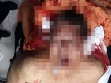 【閲覧注意】ペルー元大統領が拳銃自殺、ヤバすぎる遺体画像が流出！ 頭蓋骨が完全に割れ、口の中にチューブ、“死体を捧げる“遺書も…！
