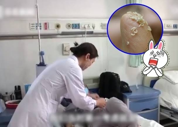 体内で2センチに成長……「がんが治る」民間療法を信じた中国人女性、肺や腸が数千匹の蛆虫に侵食されるの画像1