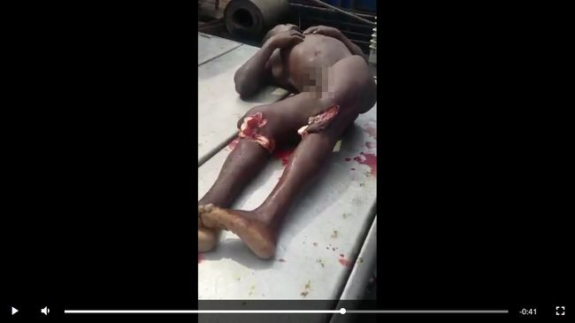 【閲覧注意】サメに膝をごっそり持っていかれた男が悲惨すぎる! 鮮血したたる肉と骨が露出… もはや歩行は絶望的かの画像4
