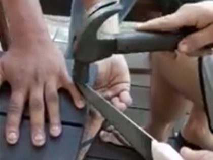 奇病 片手が勝手に動く エイリアンハンド症候群 が怖すぎる 原因 治療法不明 自分に危害を加えることも