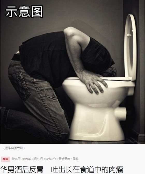 泥酔して腫瘍を吐き出した後、飲み込んだ中国人がやばい! 15センチの「肉団子」が飛び出し…の画像1