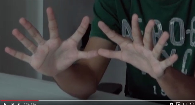 多指症は5本指より器用＆便利だったことが判明！ タイピング、ゲームも断然有利で… 研究者も衝撃「ロボットは6本指にするべき」の画像1