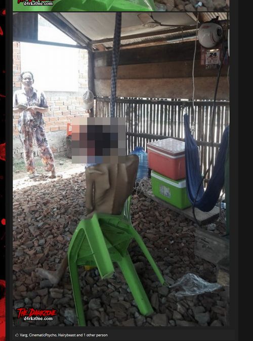 【閲覧注意】史上最も痛ましい首吊り自殺画像! 口腔がんでクチが完全崩壊した18歳男性… 満足な治療を受けられず=カンボジアの画像1
