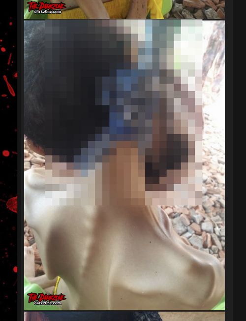 【閲覧注意】史上最も痛ましい首吊り自殺画像! 口腔がんでクチが完全崩壊した18歳男性… 満足な治療を受けられず=カンボジアの画像4