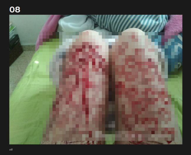【閲覧注意】太ももをザクザク切り刻むメンヘラ自傷女子がヤバすぎる! 鮮血でお絵描きも… 映えすぎたインスタ投稿に戦慄!の画像1