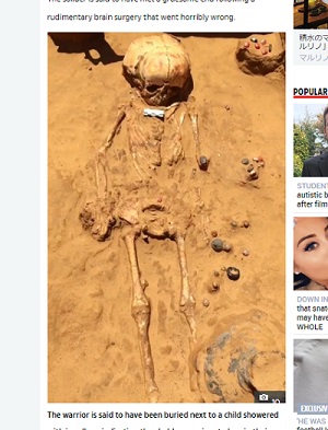 【閲覧注意】1800年前の「脳外科手術の失敗」で死んだ男の遺骨がヤバすぎる! 頭蓋骨に巨大な穴、傍らに謎の上級子供…=ロシアの画像2