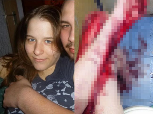 【超・閲覧注意】自傷癖のあるド美女がモンスターに変貌! 鮮血あふれ、骨と肉が露出する傷口がヤバすぎるの画像1