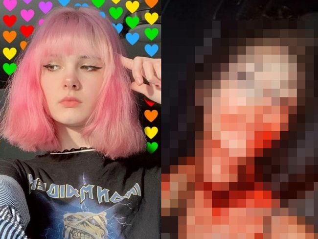【超・閲覧注意】17歳有名インスタグラマーが首を切られて惨殺される! 血まみれの遺体画像をネットに晒されて大ニュースに=米の画像1