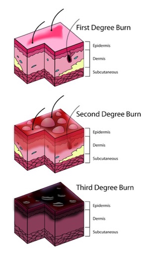 3ページ目 誰も知らない ガソリンの怖すぎる威力 を亜留間次郎が科学的に解説 人体への影響 破壊力 兵器化 歴史が証明するガソリンの闇ｰトカナ