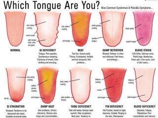 舌でわかるアナタの健康状態、4つのポイントを紹介！ 白っぽいとカンジダが… 健康改善法もアドバイス！