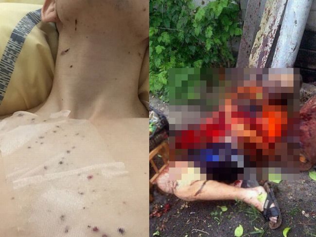 【閲覧注意】不発弾爆発で死傷した人々の悲惨すぎる姿! 内臓破裂、肉片飛散、破片めり込み… 相次ぐ事故は現代人への警鐘か!?の画像1