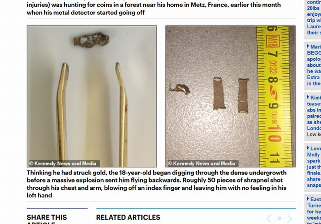 【閲覧注意】不発弾爆発で死傷した人々の悲惨すぎる姿! 内臓破裂、肉片飛散、破片めり込み… 相次ぐ事故は現代人への警鐘か!?の画像3