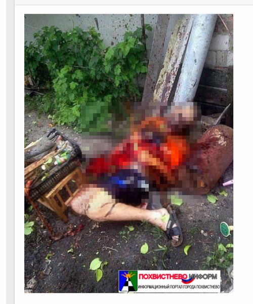 【閲覧注意】不発弾爆発で死傷した人々の悲惨すぎる姿! 内臓破裂、肉片飛散、破片めり込み… 相次ぐ事故は現代人への警鐘か!?の画像6