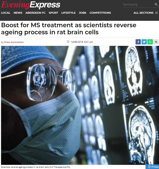 ついに夢の「リバース・エイジング」実験成功! 老人が若者に…脳がマジで若返った意外な条件とは!?の画像2