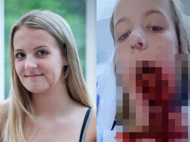 【閲覧注意】セレブ美少女15歳が乗馬中の事故でヤバすぎる顔面崩壊! 顎が完全に取れてぶらぶら… しかし奇跡が起きた=英の画像1