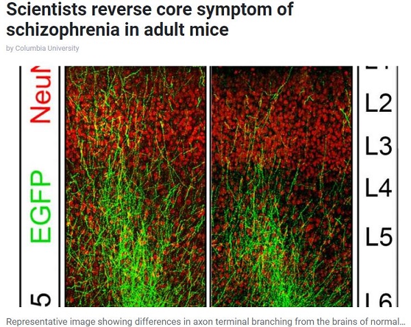 統合失調症を劇的改善する薬がついに発見される! まさかの「●●病」治療薬で脳が復活すると判明の画像2