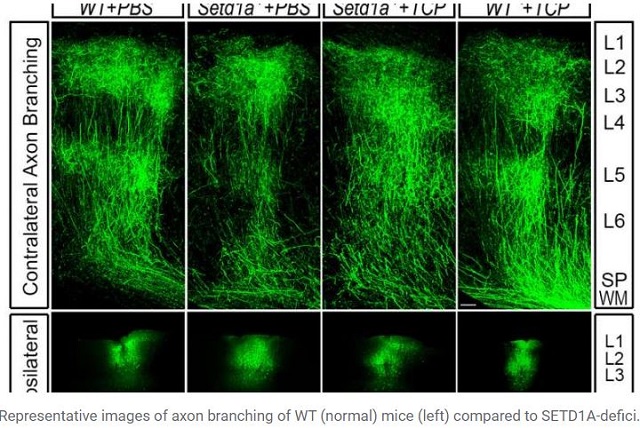 統合失調症を劇的改善する薬がついに発見される! まさかの「●●病」治療薬で脳が復活すると判明の画像3