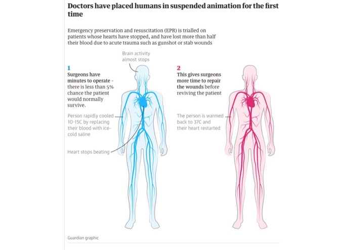 【世界初】人間の冷凍 → 蘇生試験開始を米が発表! 仮死状態にして治療する新手法EPR&人工冬眠の実現間近の画像2