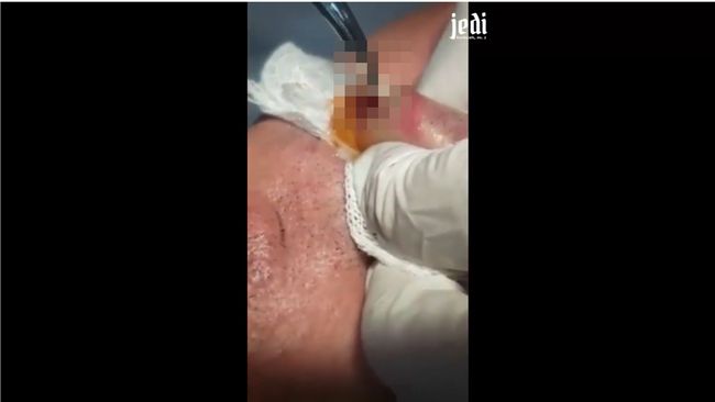 【閲覧注意】グロキモくて超スッキリな新感覚映像!男の唇から抜き出された蠢くものの正体は…!?の画像1