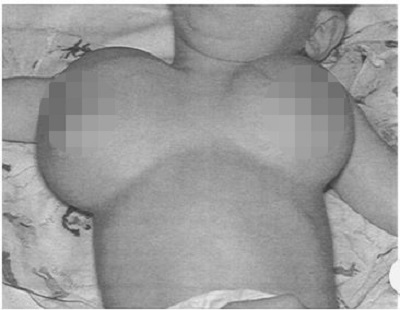 【閲覧注意】生後6カ月で超巨乳に…ロリ巨乳は不幸な希少疾患に苦しむ難病患者だった!? 亜留間次郎が解説!の画像1