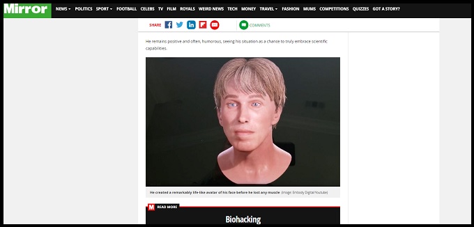 死に際「世界初のサイボーグ」変換を完了した科学者、遂にフルサイボーグに! 死なずに変容する!の画像4
