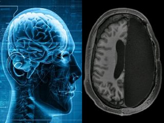 脳がカラッポの公務員がいる…人間の脳みそを半分取り除くと何が起きるのか？ 驚愕の事実判明！