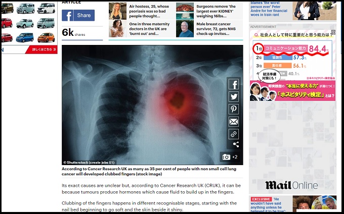 たった1秒の「肺がんセルフチェック法」とは？ 医師も推奨「シャムロス・ウィンドウ・テスト」の画像1