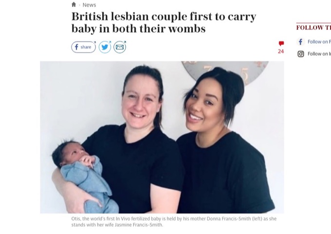 レズビアンカップルが 2人の子宮で育てた 赤ちゃんを出産 特殊デバイスで妊娠中の胎児を 入れ替え
