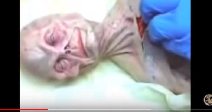 ロシア版ロズウェル「宇宙人解剖映像」が流出！ 生々しい肋骨や臓器が露わに… 68年のUFO墜落と関係か!?の画像1
