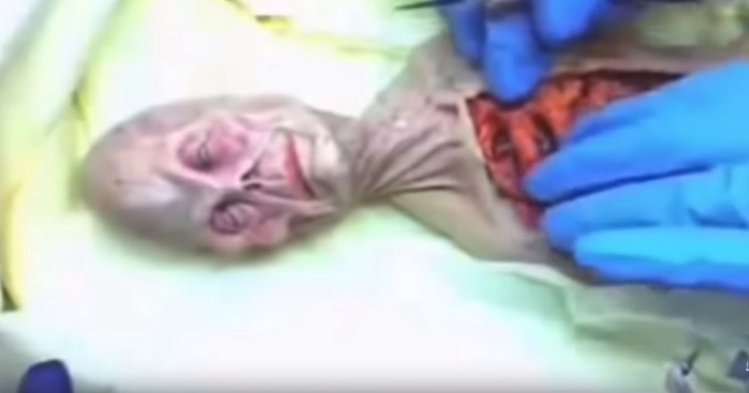 ロシア版ロズウェル「宇宙人解剖映像」が流出！ 生々しい肋骨や臓器が露わに… 68年のUFO墜落と関係か!?の画像3