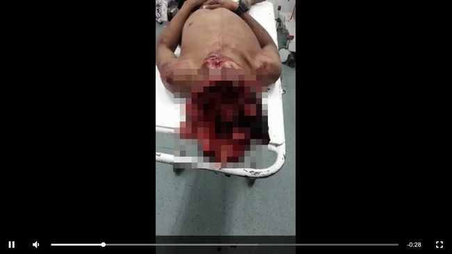 【閲覧注意】頭が空っぽになった男のヤバすぎる死体! 脳摘出後の空洞が丸見え… こうなっているのか!の画像1