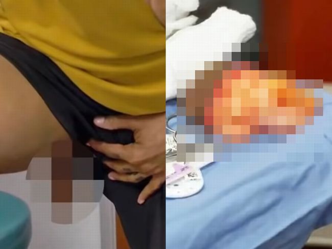 【閲覧注意】3つめの金玉をもつ男の 厄介すぎた日常とは!? 性生活も混乱、トイレでタマが水に浸り、そして…の画像1