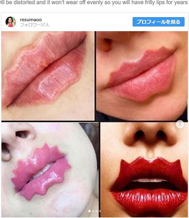 おそロシア発! ギザギザの唇「ウェービー・リップ」が最新ビューティートレンド…別名「タコの吸口」女が増殖!?の画像3