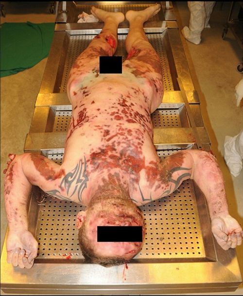 【超・閲覧注意】高度4000メートルから落下して死ぬとこうなる! 「スカイダイビング自殺」した男の遺体画像がヤバすぎる!の画像4