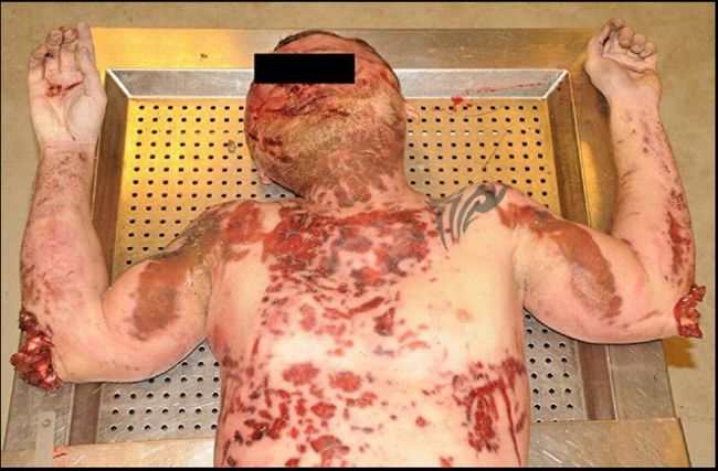 【超・閲覧注意】高度4000メートルから落下して死ぬとこうなる! 「スカイダイビング自殺」した男の遺体画像がヤバすぎる!の画像5