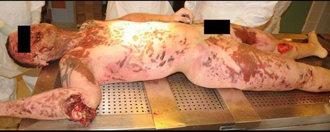 【超・閲覧注意】高度4000メートルから落下して死ぬとこうなる! 「スカイダイビング自殺」した男の遺体画像がヤバすぎる!の画像6