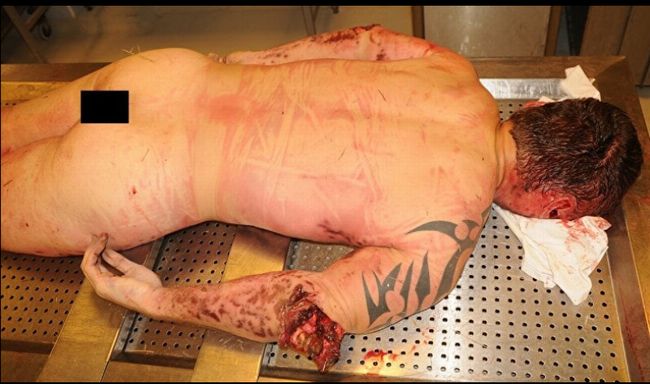 【超・閲覧注意】高度4000メートルから落下して死ぬとこうなる! 「スカイダイビング自殺」した男の遺体画像がヤバすぎる!の画像7