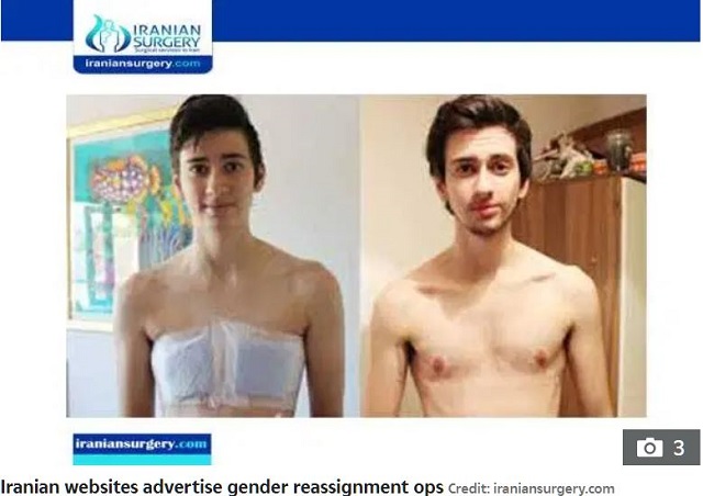 イラン政府「同性愛は病気。身体的治療が必要」! 根絶&浄化のため強制性別適合手術が横行、壮絶すぎる現状とは!?の画像3