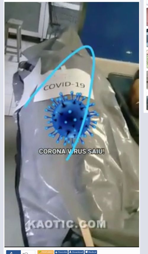 【閲覧注意】新型コロナで「完全に医療崩壊」した病院がヤバすぎる! 遺体がゴロゴロ… 早めの緊急事態宣言を!=ブラジルの画像2