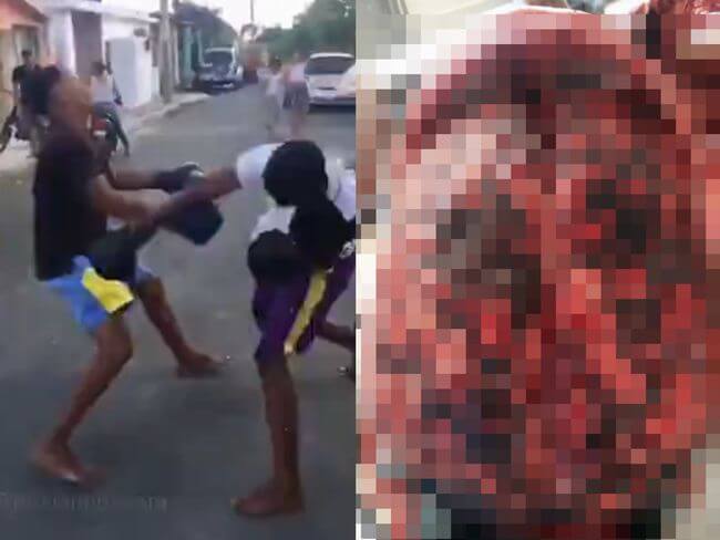 【閲覧注意】ボクシングでKOされた男が死亡 → 司法解剖で取り出された脳がヤバすぎる!! 路上格闘家の悲惨な末路=ドミニカ共和国の画像1