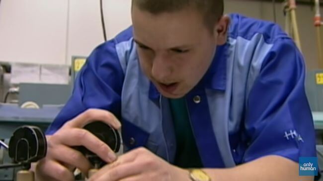 舌が5倍に膨れ上がった少年! 巨大舌が顔を埋め尽くし… 苦難と手術の末、誇りを取り戻す!の画像6