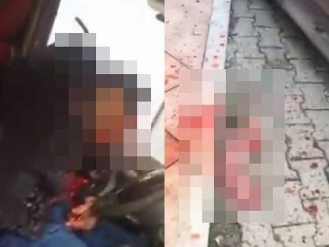 【閲覧注意】頭をショットガンで撃ち抜かれた男! 脳がすっ飛び… 土地紛争をめぐる骨肉の争い=トルコの画像1