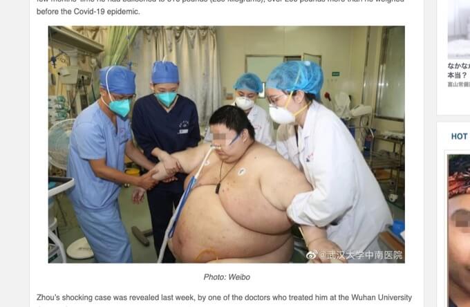 5カ月のロックダウンで 100kg太ったデブ がブヨブヨすぎる 医師から 絶望の宣告 も 中国
