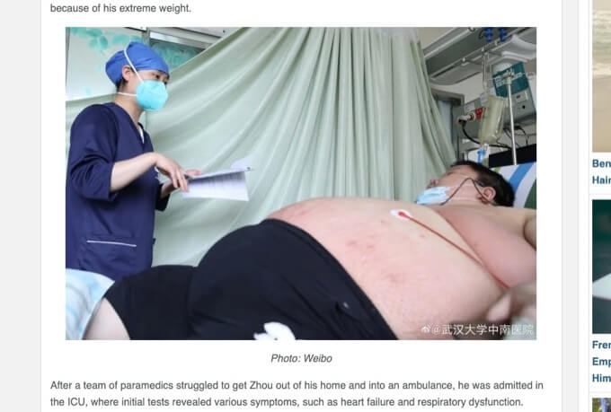 5カ月のロックダウンで「100kg太ったデブ」がブヨブヨすぎる！ 医師から絶望の宣告も！＝中国の画像3