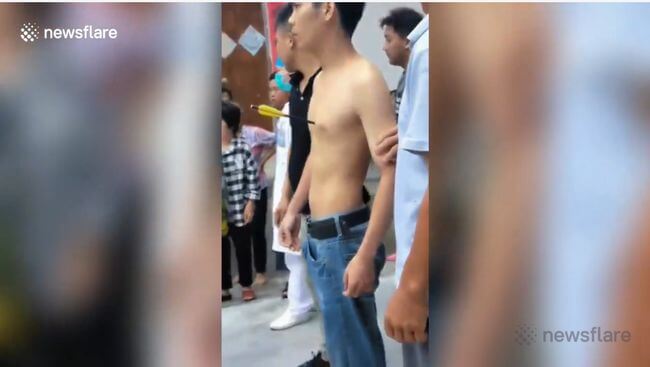 【閲覧注意】悲惨なボウガン事件が中国でも発生! 矢が刺さった人間はこうなる… 引き抜いたら死にそうな姿に衝撃=中国の画像2